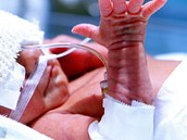 Občas si vytrhnou hadičku, pohybově bývají stejně živé jako donošená miminka. Občas si vytrhnou hadičku, pohybově bývají stejně živé jako donošená miminka.