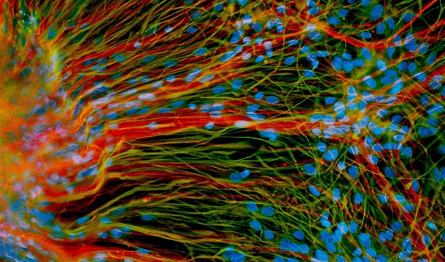 Dospělé neurony vypěstované z embryonálních kmenových buněk v laboratoři Su-Čchun Čanga z univerzity ve Wisconsinu. Embryonální kmenové buňky jsou dnes asi největší nadějí na léčbu poranění a nemocí nervových tkání, jejichž hojení je jinak velmi pomalé.