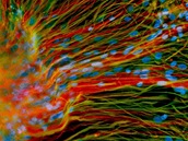 Dospělé neurony vypěstované z embryonálních kmenových buněk v laboratoři Su-Čchun Čanga z univerzity ve Wisconsinu. Embryonální kmenové buňky jsou dnes asi největší nadějí na léčbu poranění a nemocí nervových tkání, jejichž hojení je jinak velmi pomalé. Dospělé neurony vypěstované z embryonálních kmenových buněk v laboratoři Su-Čchun Čanga z univerzity ve Wisconsinu. Embryonální kmenové buňky jsou dnes asi největší nadějí na léčbu poranění a nemocí nervových tkání, jejichž hojení je jinak velmi pomalé.