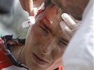 V P��I L�KA��. Zakrv�cen� Janez Brajkovi� se vzpamatov�v� po o�kliv�m p�du.  