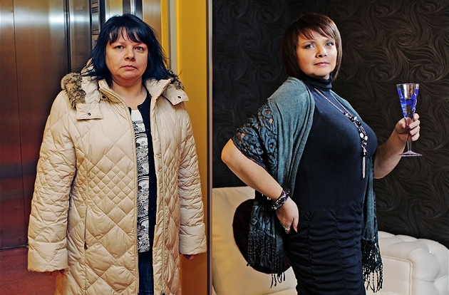 Jaroslava před svou první operací na klinice Medicom VIP a téměř rok poté zcela