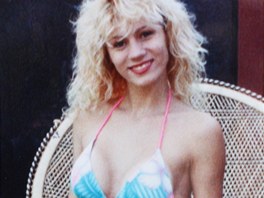 Lacey Wilddov� po sv� prvn� operaci prsou v roce 1990