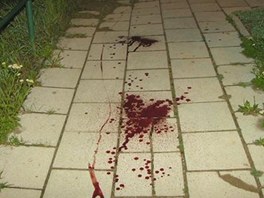 Zraněný cyklista silně krvácel z poraněné krční tepny. Policisté ho našli na Zraněný cyklista silně krvácel z poraněné krční tepny. Policisté ho našli na