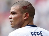 ZRAN�N� Portugalsk� stoper Pepe z Realu Madrid po sr�ce s vlastn�m brank��em
