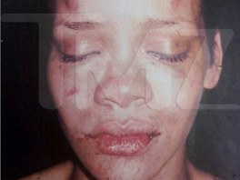 Zml�cen� Rihanna - fotografii zve�ejnil port�l TMZ.com