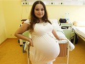 Alexandra Kiňová očekává narození paterčat. Byla počata přirozenou cestou. Podle lékařů jde o velký unikát. (27. května 2013) Alexandra Kiňová očekává narození paterčat. Byla počata přirozenou cestou. Podle lékařů jde o velký unikát. (27. května 2013)
