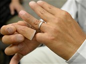 Protéza malíčku vyjde v přepočtu na 30 tisíc korun Protéza malíčku vyjde v přepočtu na 30 tisíc korun